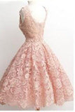 Vintage A-line Scalloped-Edge Knee-Length Lace Light Pink Prom Homecoming Dress RJS874 Rjerdress