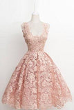 Vintage A-line Scalloped-Edge Knee-Length Lace Light Pink Prom Homecoming Dress RJS874